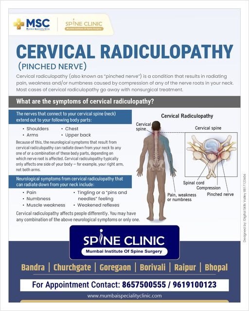 cervical radiculopathy