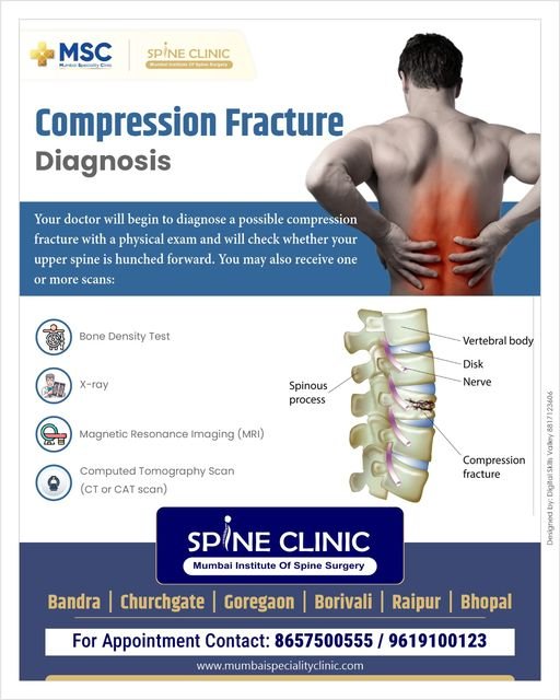 Compression Fractures