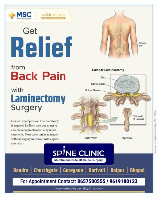 Laminectomy Surgery | Mumbai Speciality Clinic