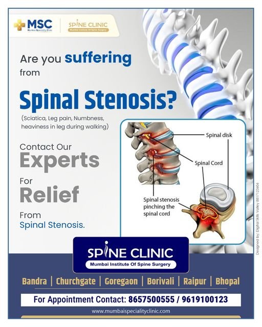 Spinal Stenosis: Symptoms, Causes, and Treatment | Mumbai Speciality Clinic