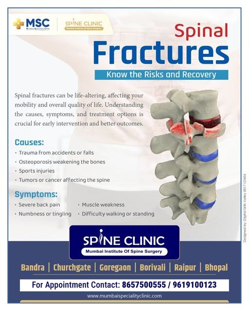 Spinal Fractures | Mumbai Speciality Clinic