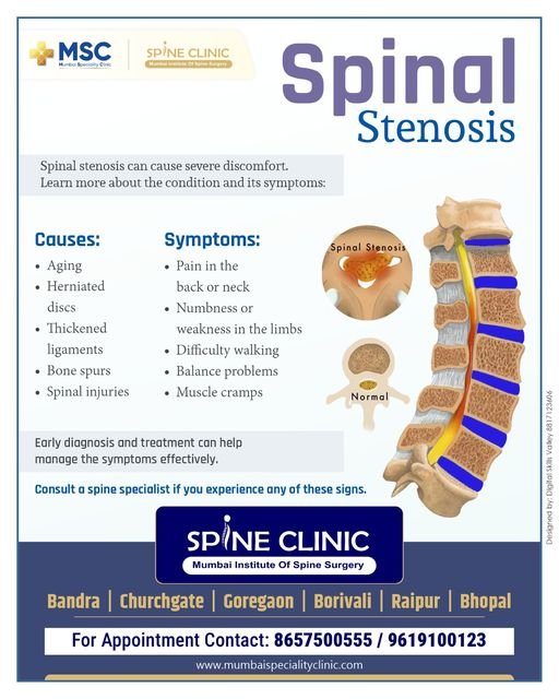 Spinal Stenosis | Mumbai Speciality Clinic